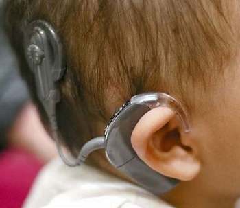 Niños sordos con implante coclear aprenden el lenguaje más rápido de lo que creemos